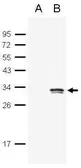Anti-GFP antibody used in Western Blot (WB). GTX124117