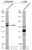Anti-MSH2 antibody used in Western Blot (WB). GTX124131
