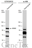 Anti-MSH2 antibody [N3C2], Internal used in Western Blot (WB). GTX124132