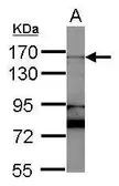 Anti-Rad50 antibody [N1N2], N-term used in Western Blot (WB). GTX124140