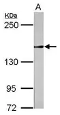 Anti-Rad50 antibody [N3C2], Internal used in Western Blot (WB). GTX124141
