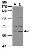 Anti-ZNF350 antibody [C1C3] used in Western Blot (WB). GTX124169
