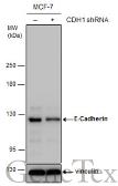 Anti-E-Cadherin antibody [N3C2], Internal used in Western Blot (WB). GTX124178