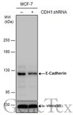 Anti-E-Cadherin antibody [N3C2], Internal used in Western Blot (WB). GTX124178