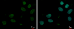 Anti-MYT1L antibody used in Immunocytochemistry/ Immunofluorescence (ICC/IF). GTX124184