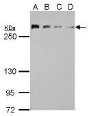 Anti-CHD4 antibody used in Western Blot (WB). GTX124186