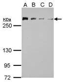 Anti-CHD4 antibody used in Western Blot (WB). GTX124186