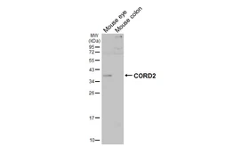 Anti-CORD2 antibody used in Western Blot (WB). GTX124188