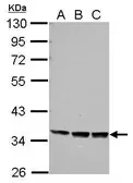 Anti-Protor 1 antibody used in Western Blot (WB). GTX124197