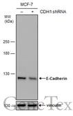 Anti-E-Cadherin antibody used in Western Blot (WB). GTX124198
