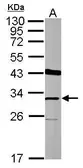 Anti-THAP11 antibody used in Western Blot (WB). GTX124201