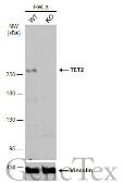 Anti-TET2 antibody [N2], N-term used in Western Blot (WB). GTX124204