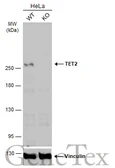 Anti-TET2 antibody [N2], N-term used in Western Blot (WB). GTX124204