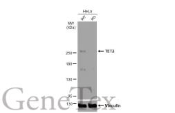 Anti-TET2 antibody [N2-2], N-term used in Western Blot (WB). GTX124205
