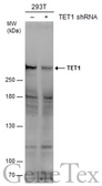 Anti-TET1 antibody [N3C1] used in Western Blot (WB). GTX124207