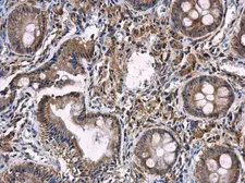 Anti-iNOS antibody [N1N2-2], N-term used in IHC (Paraffin sections) (IHC-P). GTX124210
