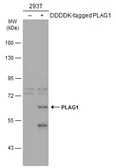 Anti-PLAG1 antibody used in Western Blot (WB). GTX124217