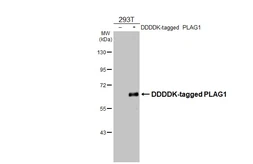 Anti-PLAG1 antibody used in Western Blot (WB). GTX124217
