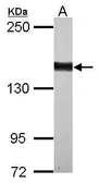 Anti-DZIP3 antibody [C1C2-2], Internal used in Western Blot (WB). GTX124219