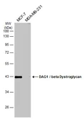 Anti-DAG1 / beta Dystroglycan antibody [C2C3-2], C-term used in Western Blot (WB). GTX124225