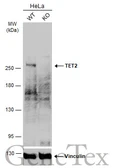 Anti-TET2 antibody used in Western Blot (WB). GTX124227