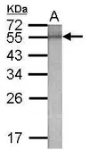 Anti-Beta-gal antibody used in Western Blot (WB). GTX124230