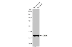 Anti-CTGF antibody used in Western Blot (WB). GTX124232