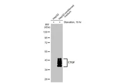 Anti-CTGF antibody used in Western Blot (WB). GTX124232