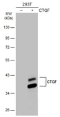 Anti-CTGF antibody used in Western Blot (WB). GTX124233