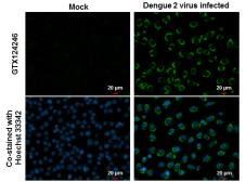 Anti-Dengue virus NS2B protein antibody used in Immunocytochemistry/ Immunofluorescence (ICC/IF). GTX124246