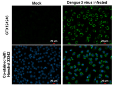 Anti-Dengue virus NS2B protein antibody used in Immunocytochemistry/ Immunofluorescence (ICC/IF). GTX124246
