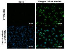 Anti-Dengue virus NS4B protein antibody used in Immunocytochemistry/ Immunofluorescence (ICC/IF). GTX124250