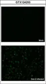 Anti-Dengue virus NS5 protein antibody used in Immunocytochemistry/ Immunofluorescence (ICC/IF). GTX124253