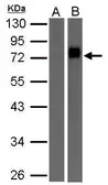 Anti-Biotin antibody used in Western Blot (WB). GTX124262