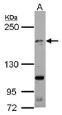 Anti-TNIK antibody used in Western Blot (WB). GTX124264