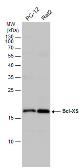 Anti-Bcl-XS antibody used in Western Blot (WB). GTX124266