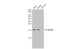 Anti-Bcl-XS antibody used in Western Blot (WB). GTX124266