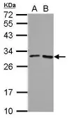 Anti-FOLR4 antibody used in Western Blot (WB). GTX124270