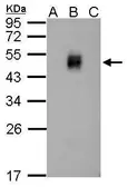 Anti-Dengue virus NS1 protein antibody used in Western Blot (WB). GTX124280