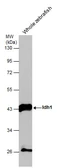 Anti-Idh1 antibody used in Western Blot (WB). GTX124320