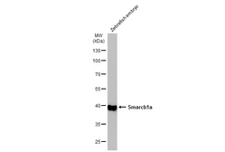 Anti-Smarcb1a antibody used in Western Blot (WB). GTX124337