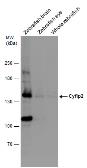 Anti-Cyfip2 antibody used in Western Blot (WB). GTX124387
