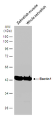 Anti-Bactin1 antibody used in Western Blot (WB). GTX124388
