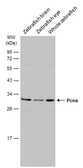 Anti-Pcna antibody used in Western Blot (WB). GTX124496