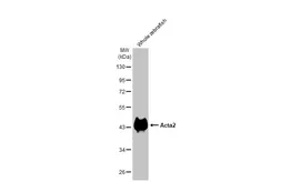 Anti-Acta2 antibody used in Western Blot (WB). GTX124505