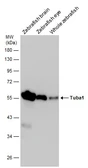 Anti-Tuba1 antibody used in Western Blot (WB). GTX124965