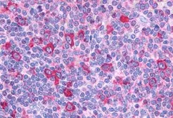 Anti-GPR132 antibody used in IHC (Paraffin sections) (IHC-P). GTX12530