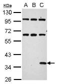 Anti-Renilla Luciferase antibody used in Western Blot (WB). GTX125852