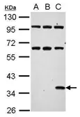 Anti-Renilla Luciferase antibody used in Western Blot (WB). GTX125852