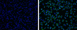 Anti-Japanese encephalitis virus NS1 antibody used in Immunocytochemistry/ Immunofluorescence (ICC/IF). GTX125866